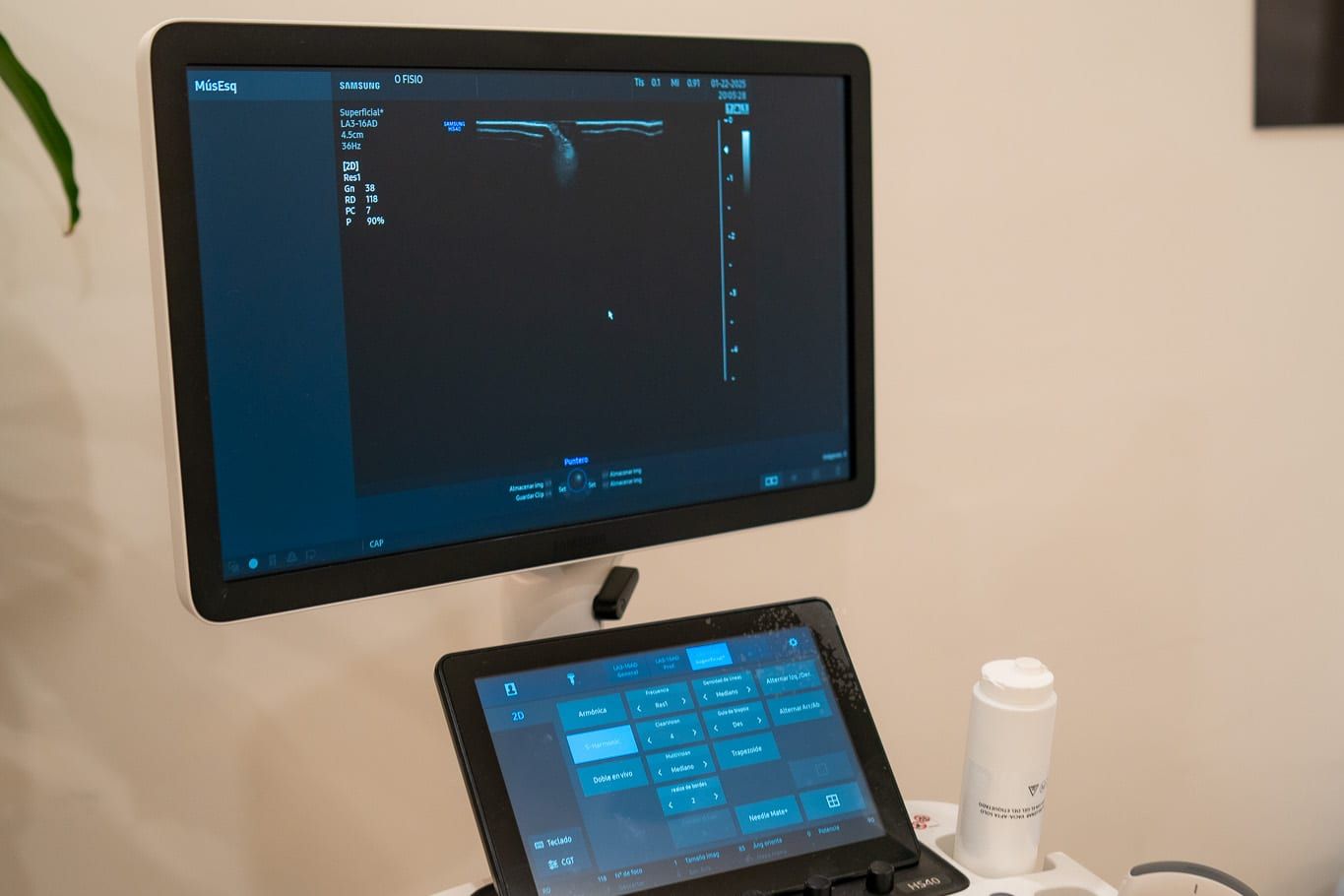 Ecógrafo de Ofisio con la pantalla encendida y la consola de control